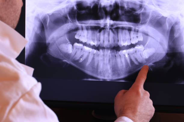 Best Emergency Tooth Extraction in Hermantown, MN