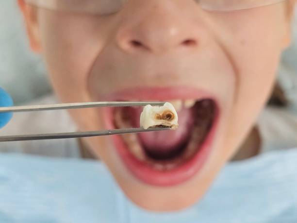 Best Weekend Emergency Dentist in Hermantown, MN